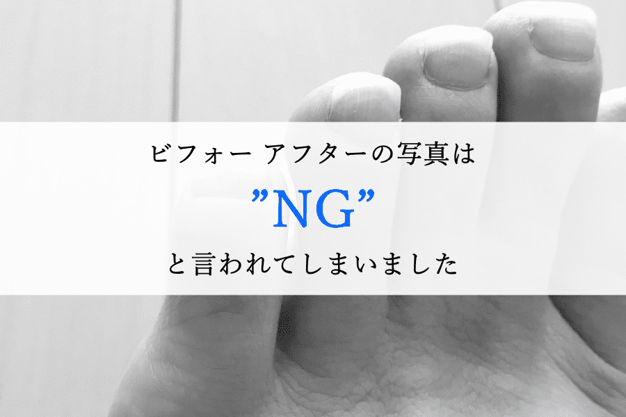 ビフォーアフターの写真は”NG”と言われてしまいました